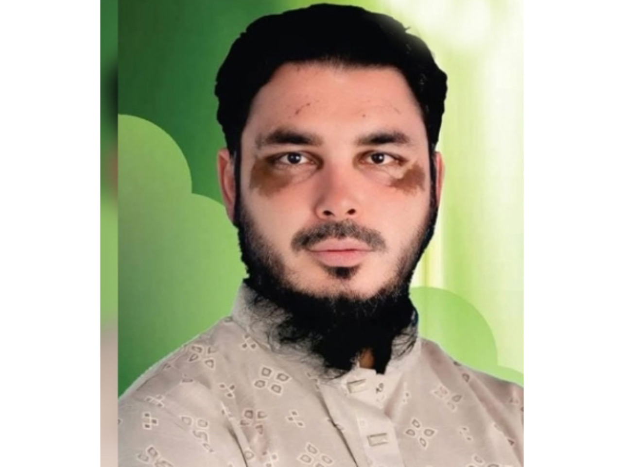 বিশ্ববিদ্যালয় শিক্ষার্থীকে ধর্ষণের হুমকি দেওয়ার অভিযোগ রাজশাহীর স্বেচ্ছাসেবক নেতা শান্ত'র বিরুদ্ধে - প্রভাতী নিউজ  - অপরাধ