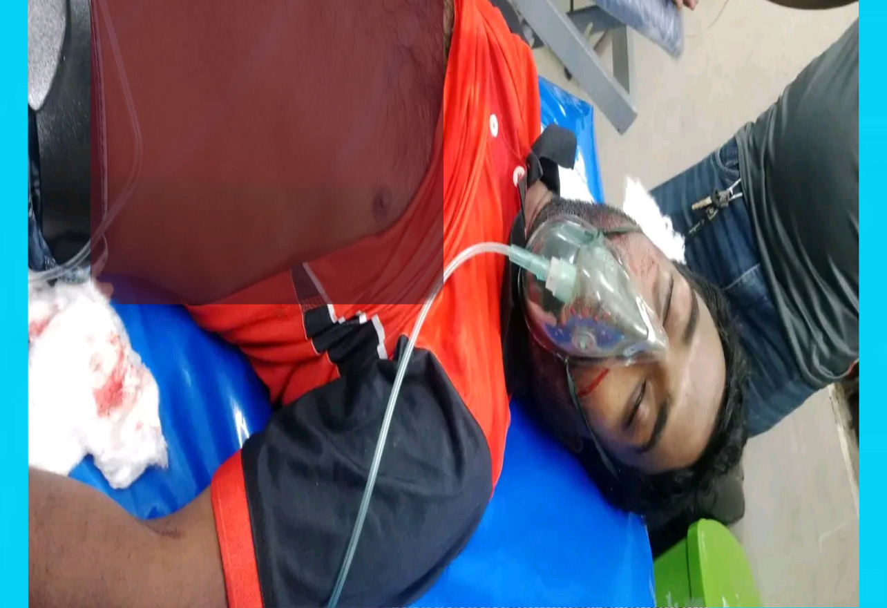 চৌগাছায় দাদির মরদেহ দেখতে এসে নাতির মৃত্যু, আহত ৩ - প্রভাতী নিউজ  - সারাদেশ