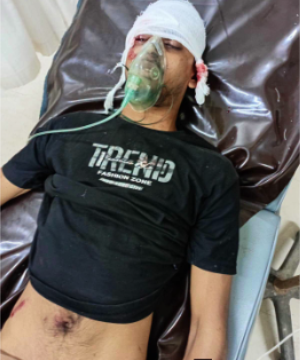 চৌগাছায় নিয়ন্ত্রণ হারিয়ে মোটরসাইকেল দুর্ঘটনা, আহত ৩ তরুণ; একজনকে যশোরে রেফার